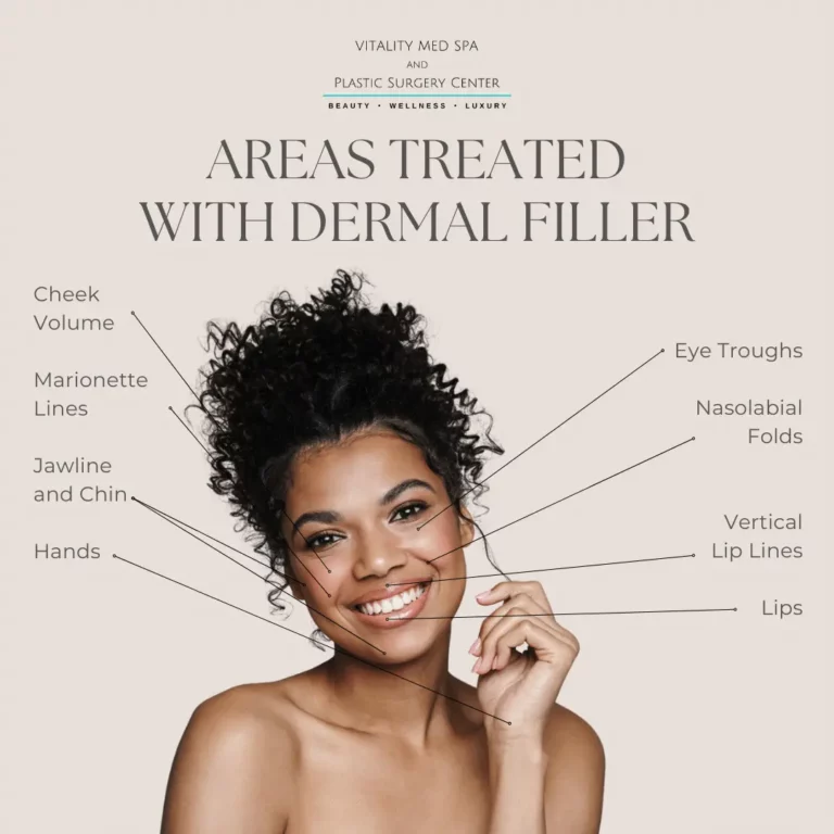 Dermal Fillers Treatment in Peachtree City, GA