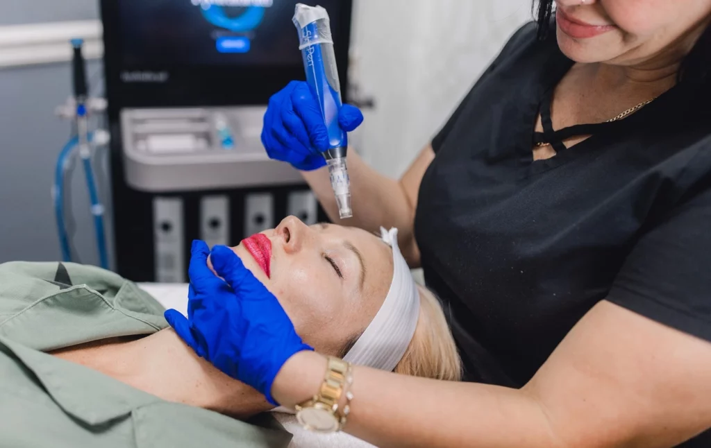 Microneedling Treatment in Sawanee, GA