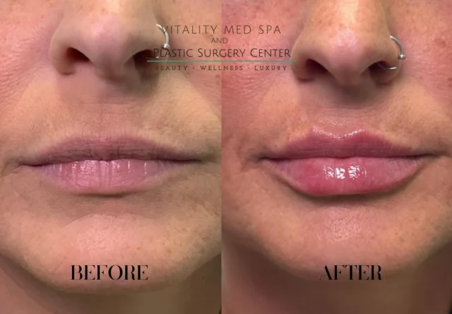 Vitality Med Spa and Plastic Surgery Center - Image 2