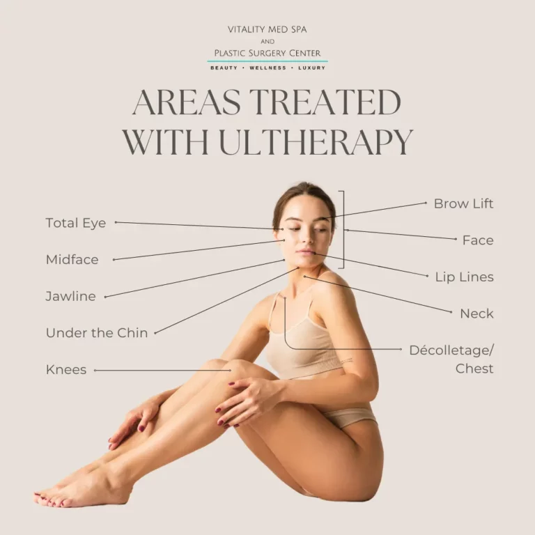 Ultherapy Treatment