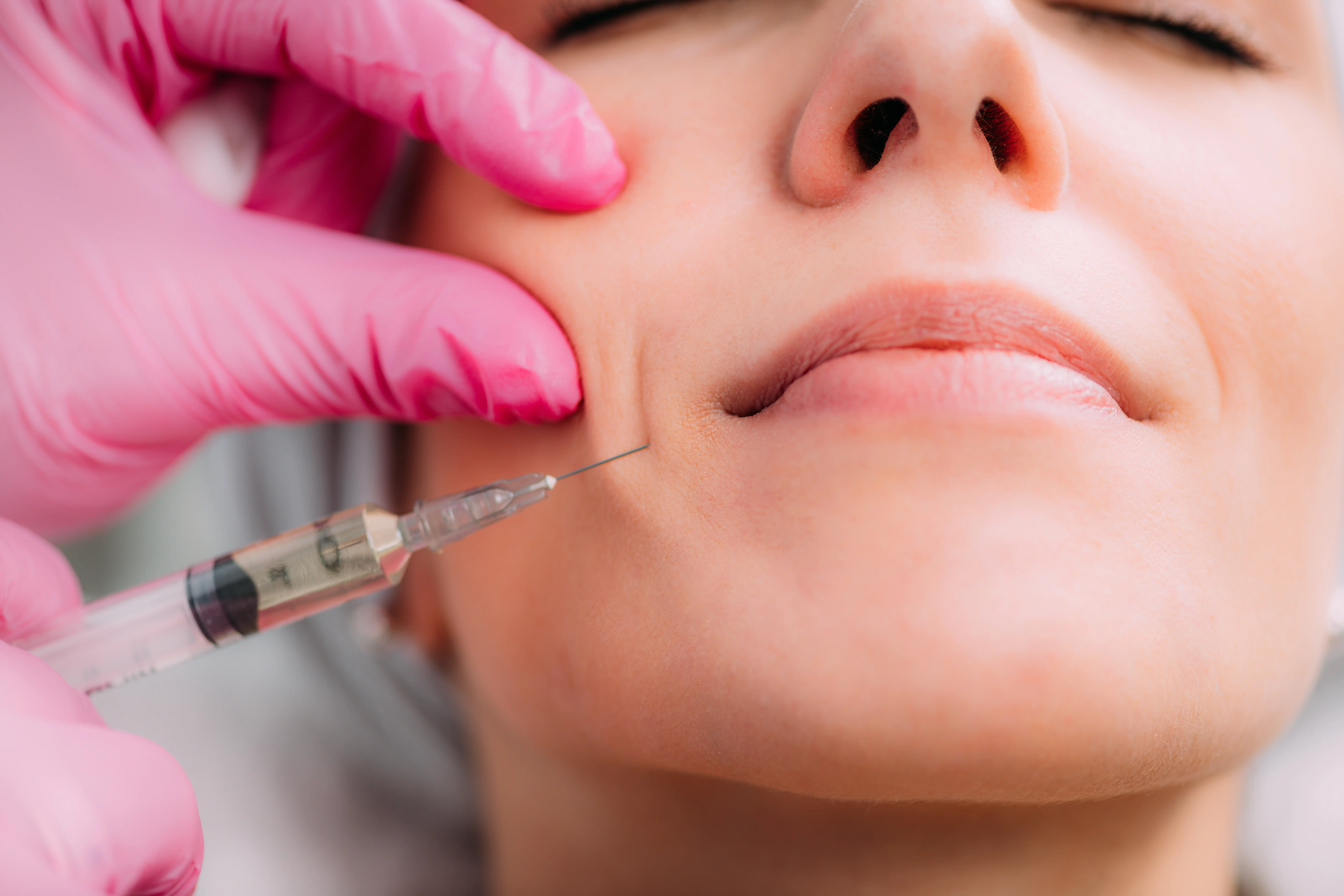 Dermal Fillers in Georgia