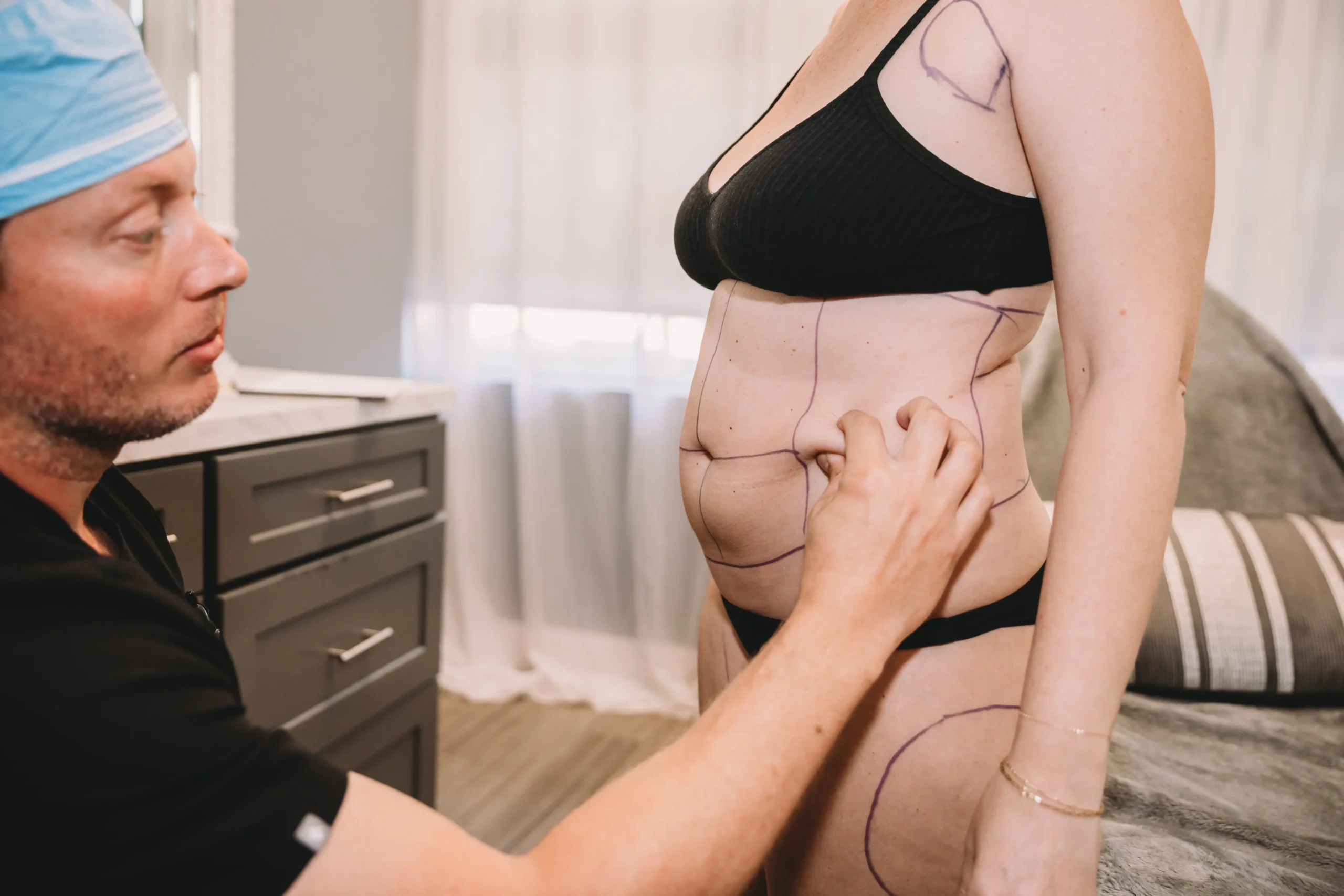 Expert Liposuction in Suwanee, GA